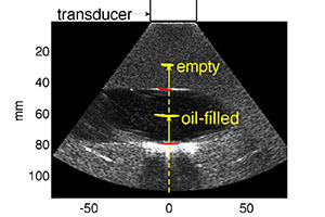 This ultrasound image shows a cavity filled with olive oil. Dashed and solid vertical lines indicate the proton beam path through material with relative stopping powers near 0 and 1, respectively. Bragg peaks from both empty and filled cavities are overlaid in yellow. Overlaid in red are estimates of entrance point of beam into the material with high stopping power, in agreement with the ultrasound image.