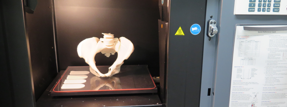 Image of 3D printed pelvis bone structure inside of our 3D printer